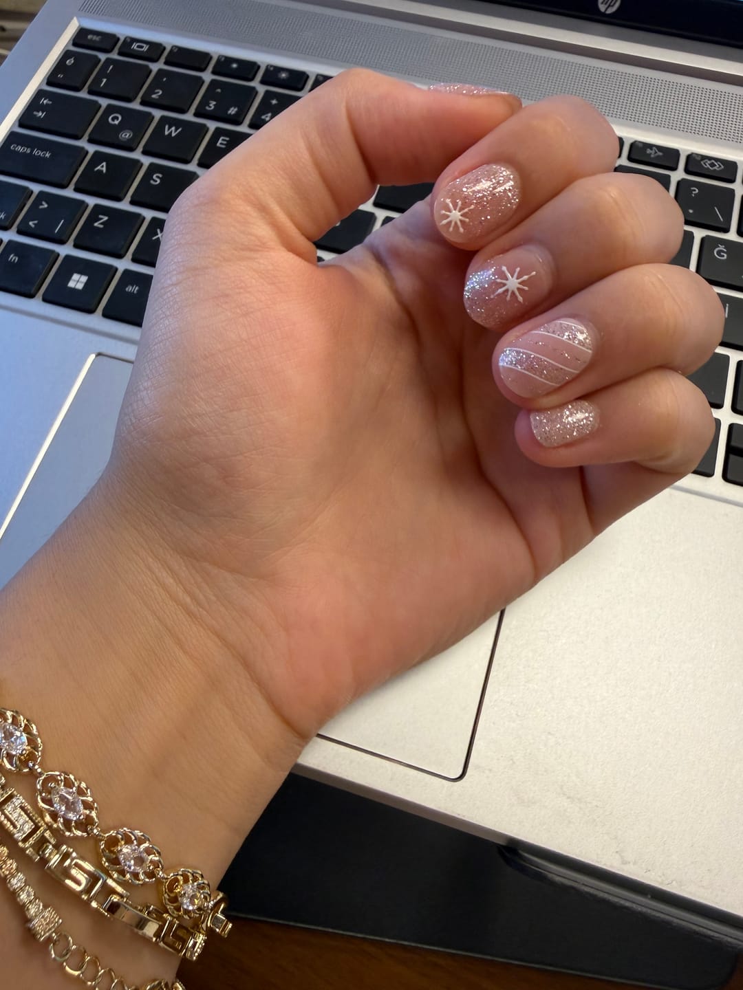 Customer photo review of N Crystal Frost Jel Tırnak 30 Adet, 2 Kullanım