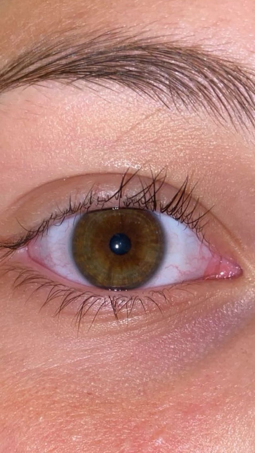 Customer photo review of LASH GROWTH SERUM