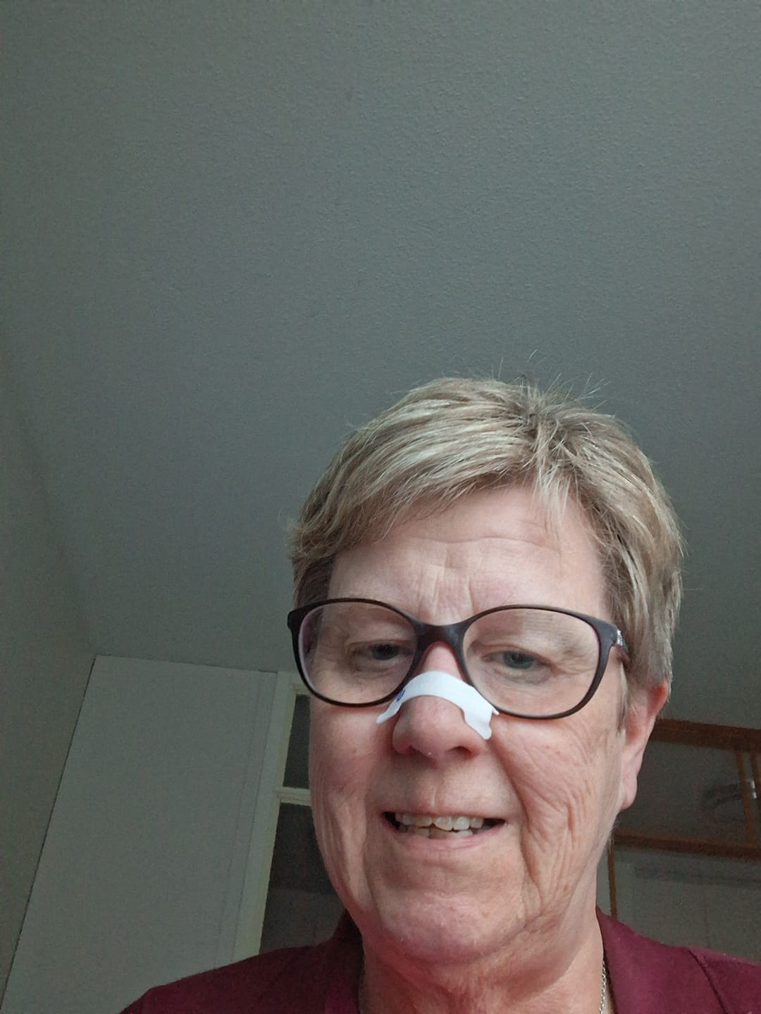 Customer photo review of Nuku Sleep Nasal Strips
