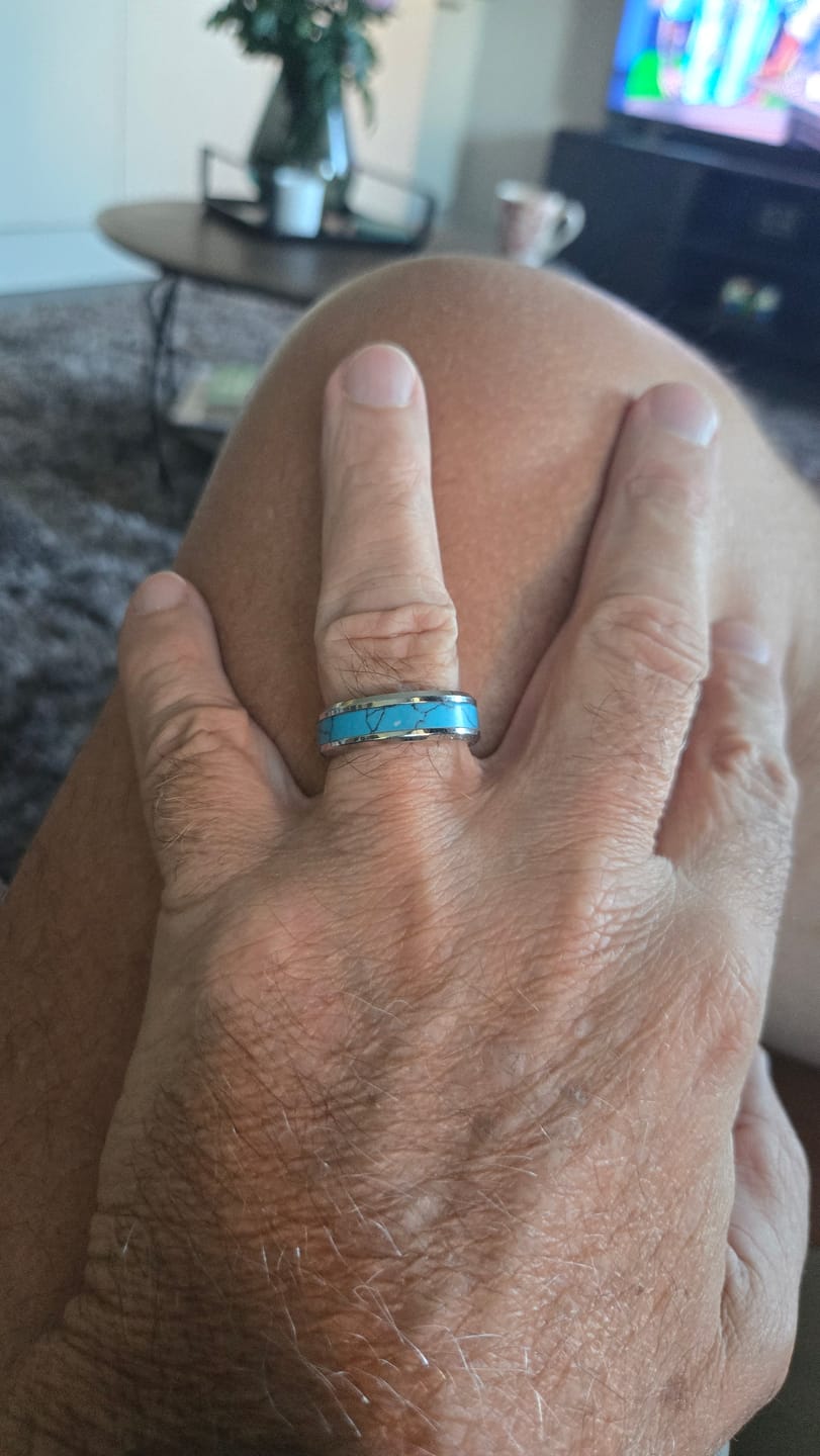 Customer photo review of TURQUOISE BAND.