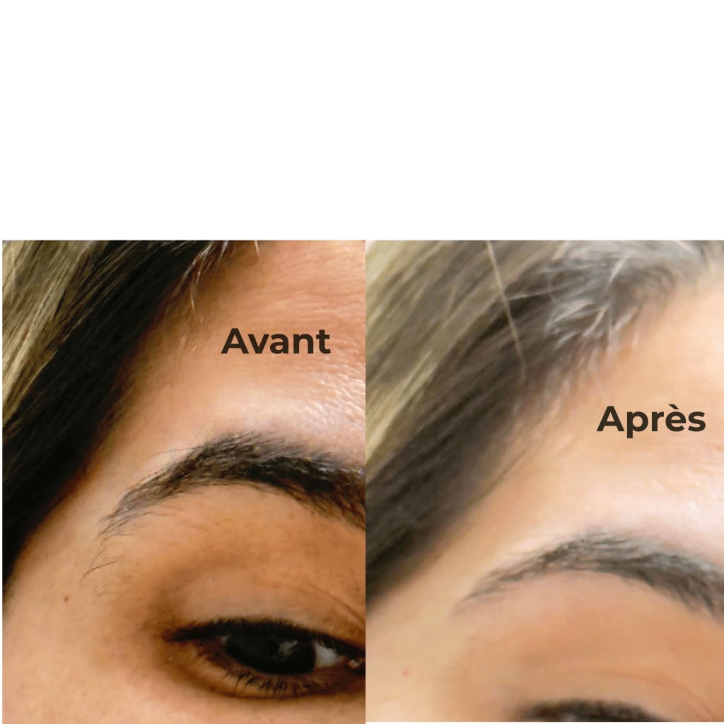 Customer photo review of MIYO™ – Tondeuse Visage & Sourcils 2-en-1