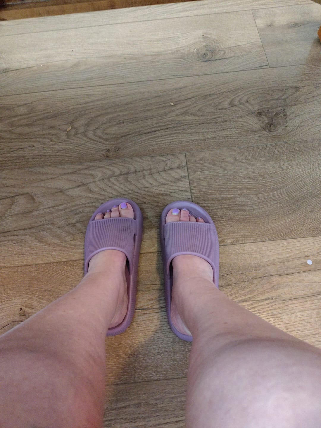 Customer photo review of Cloud Slides™ - Original Cushion Comfort