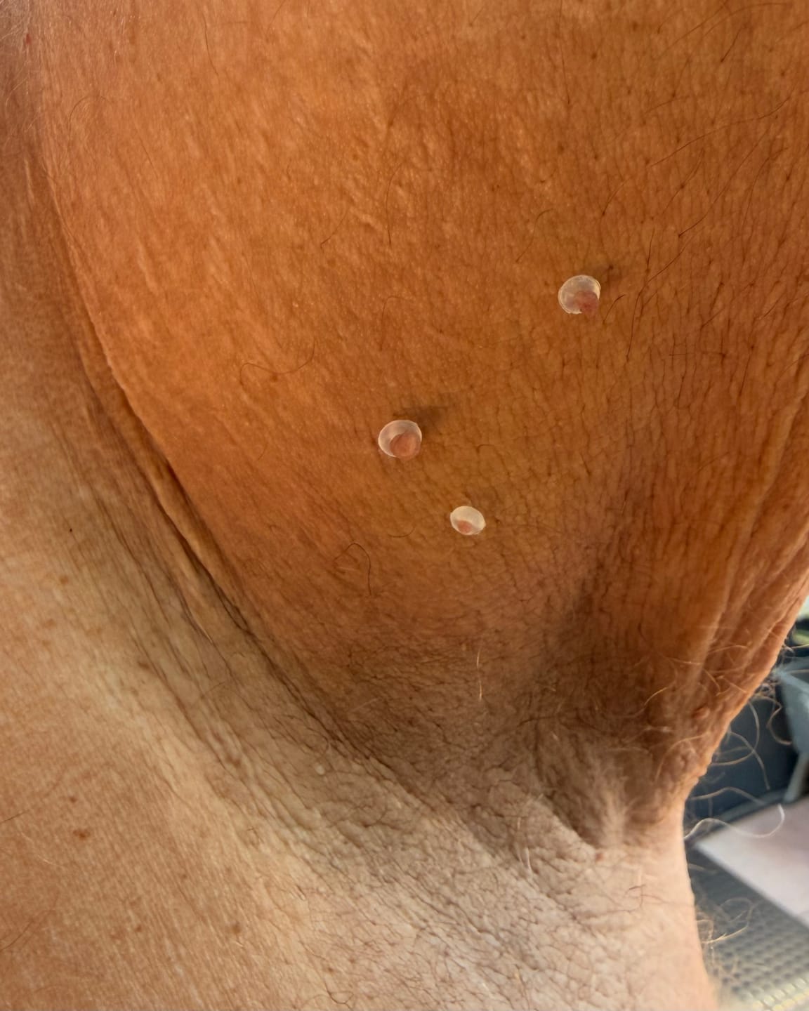 Customer photo review of Alcura™ Ersatzringe für Hautanhängsel
