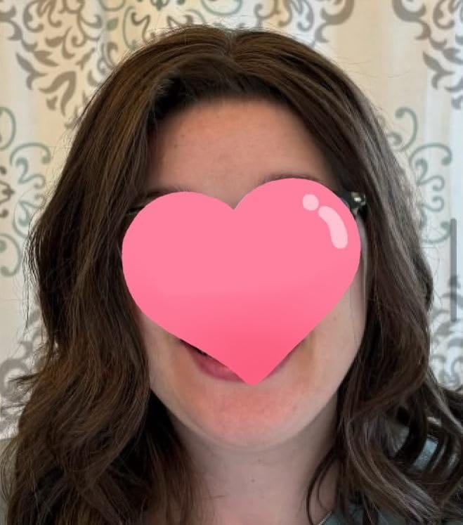 Customer photo review of Topper Hair Pieces 100% Human Hair For Women Darkest Brown #2-3*5 inch |Youngsee