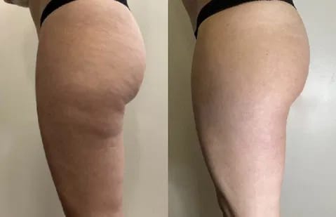 Customer photo review of Rituel Lissant Pro