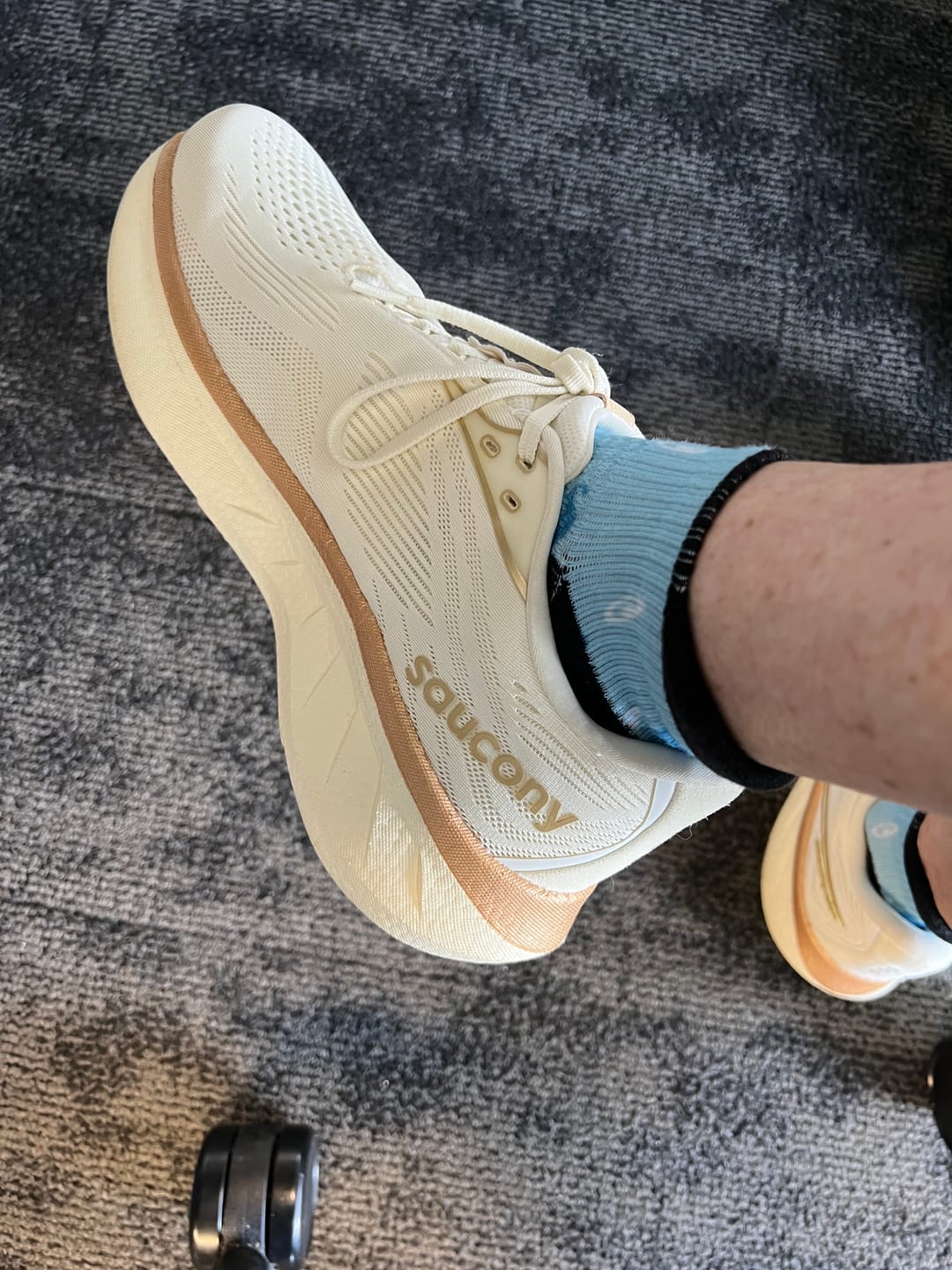 Customer photo review of Ankle Compression Socks | Bundle