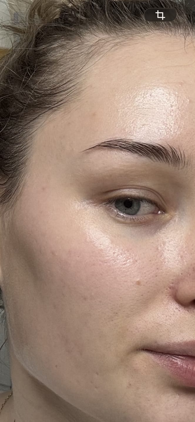 Customer photo review of Hydra Calming Creme