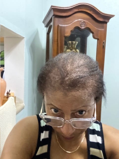 Customer photo review of Batana Oil
