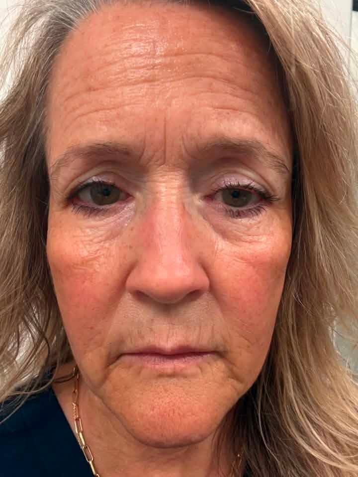 Customer photo review of The Complete System for Mature Women’s Skin
