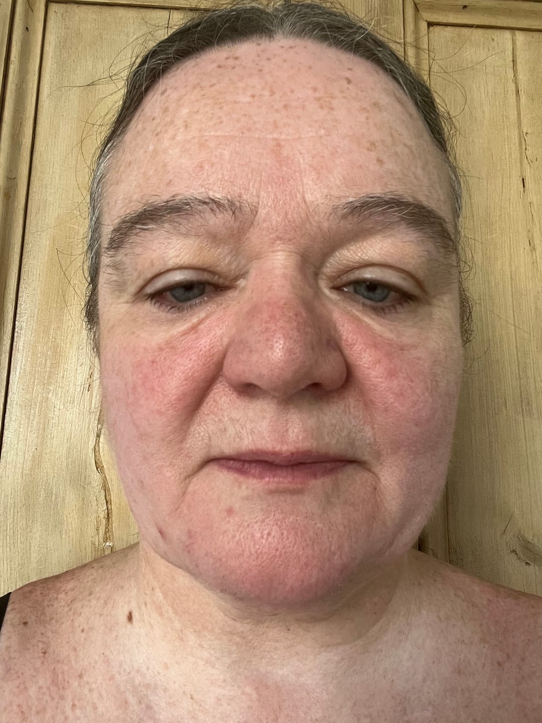 Customer photo review of 30 Days Of Age Defying Multi-Collagen