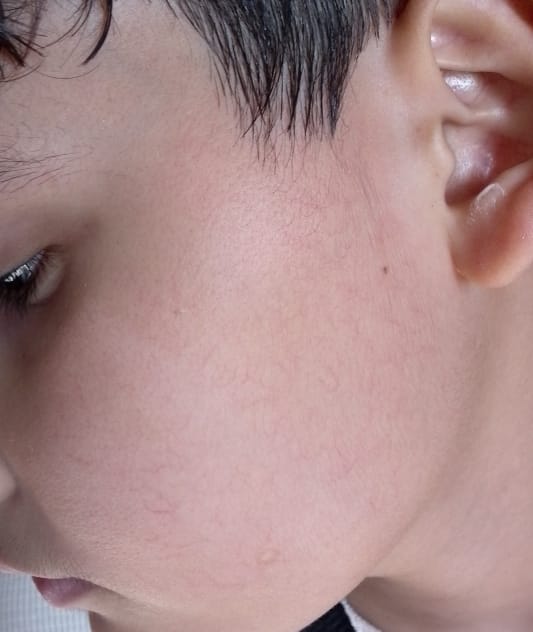 Customer photo review of Dermive Sensitive Moisturizer
