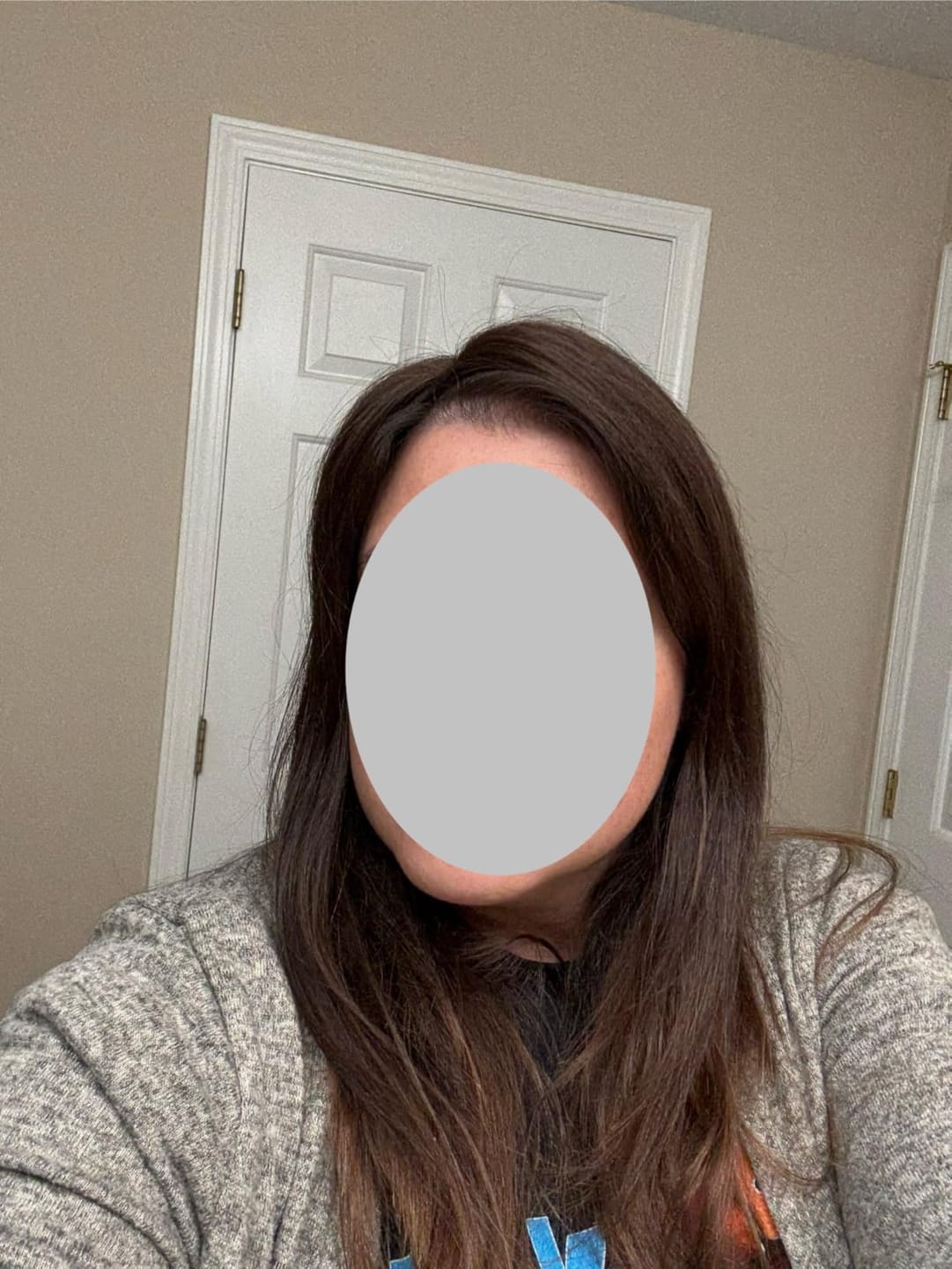 Customer photo review of Topper Hair Pieces 100% Human Hair For Women Darkest Brown #2-5*5 inches |Youngsee