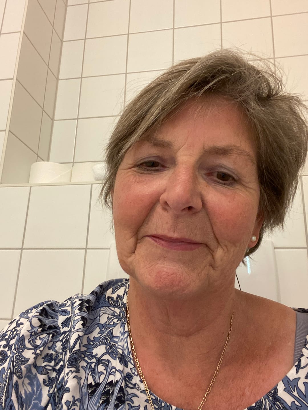 Customer photo review of Seranova Micro Infusion System™