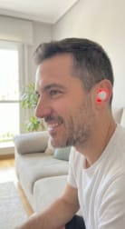 Customer photo review of AURALIS™ - Red light therapy