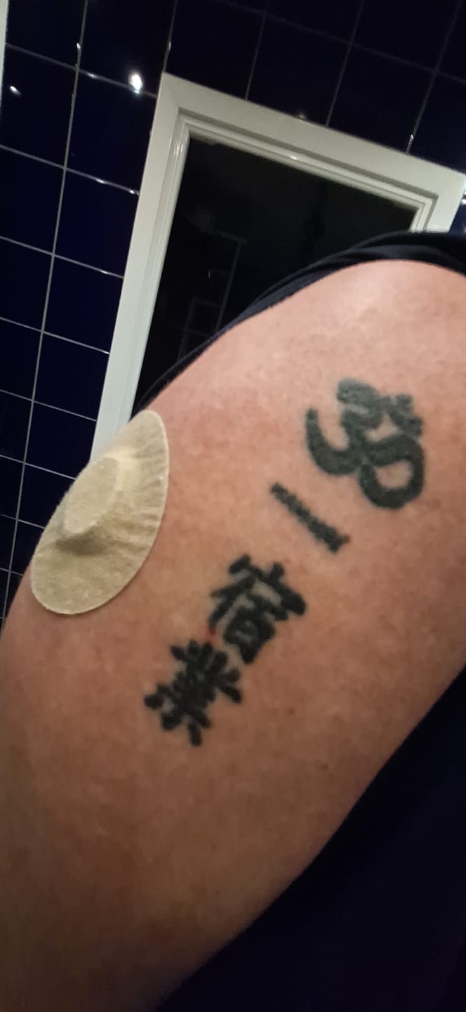 Customer photo review of Freestyle Libre 1,2 och 3 Beige sensor overpatches