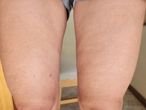 Customer photo review of Aceite Corporal Reafirmante - Combate Celulitis, Flacidez y Arrugas