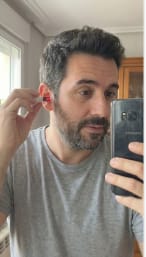 Customer photo review of AURALIS™ - Red light therapy