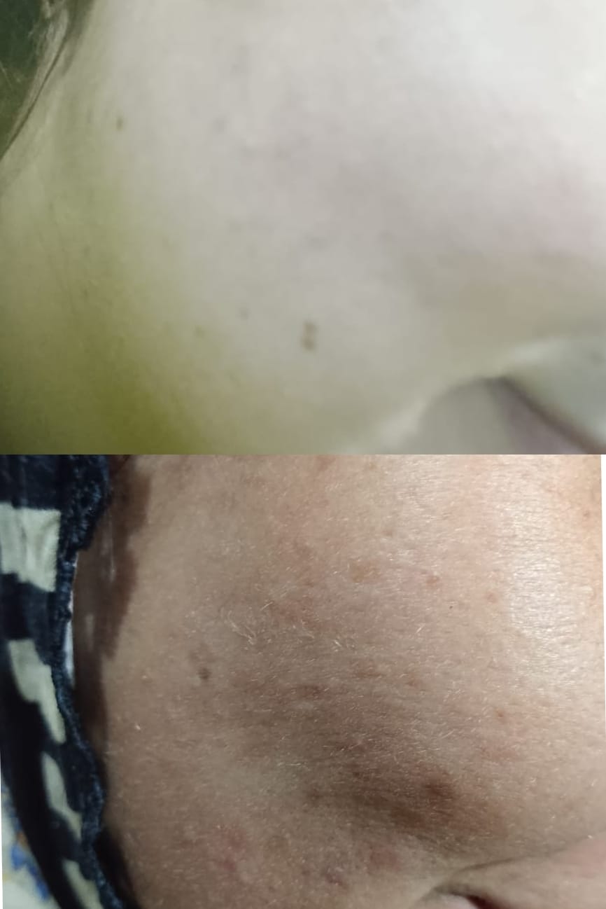 Customer photo review of MandelAC Cream