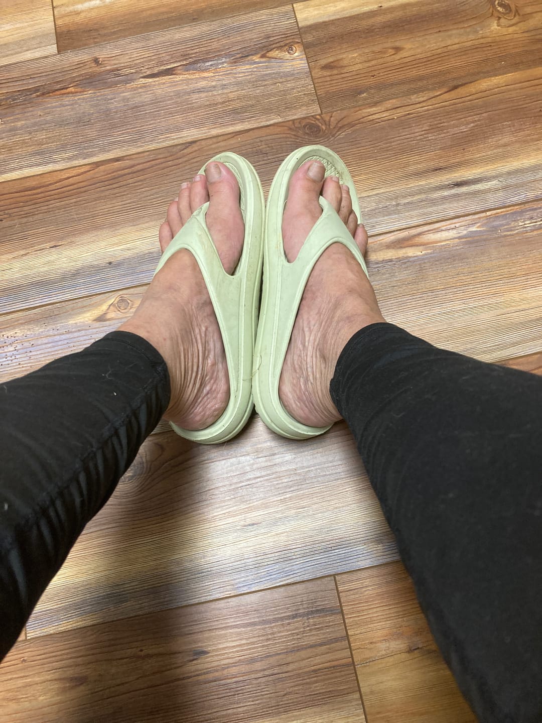 Customer photo review of Ergonomic Flip Flop with Arch Support