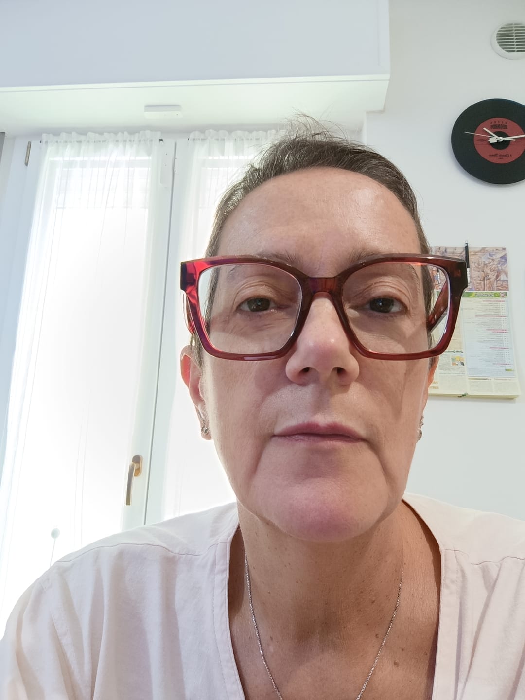 Customer photo review of BioChroma – Siero Coreano Effetto Lifting dalla Prima Applicazione
