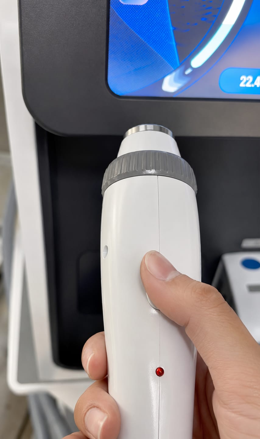 Customer photo review of Dermaluxe Pro 3-in-1 Laser System