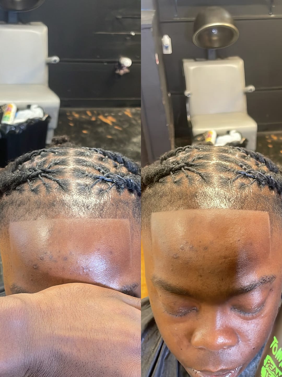 Customer photo review of Freshape Up 100 Packs – Barber Shampoo Infused Sponges for Hairline Cleaning (No Rinse)