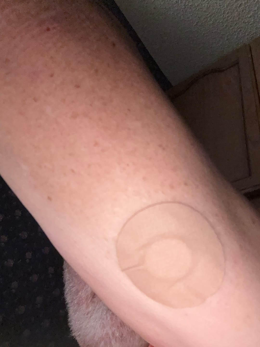 Customer photo review of Skin Grip MAX Instinct Patches - 10 Pack