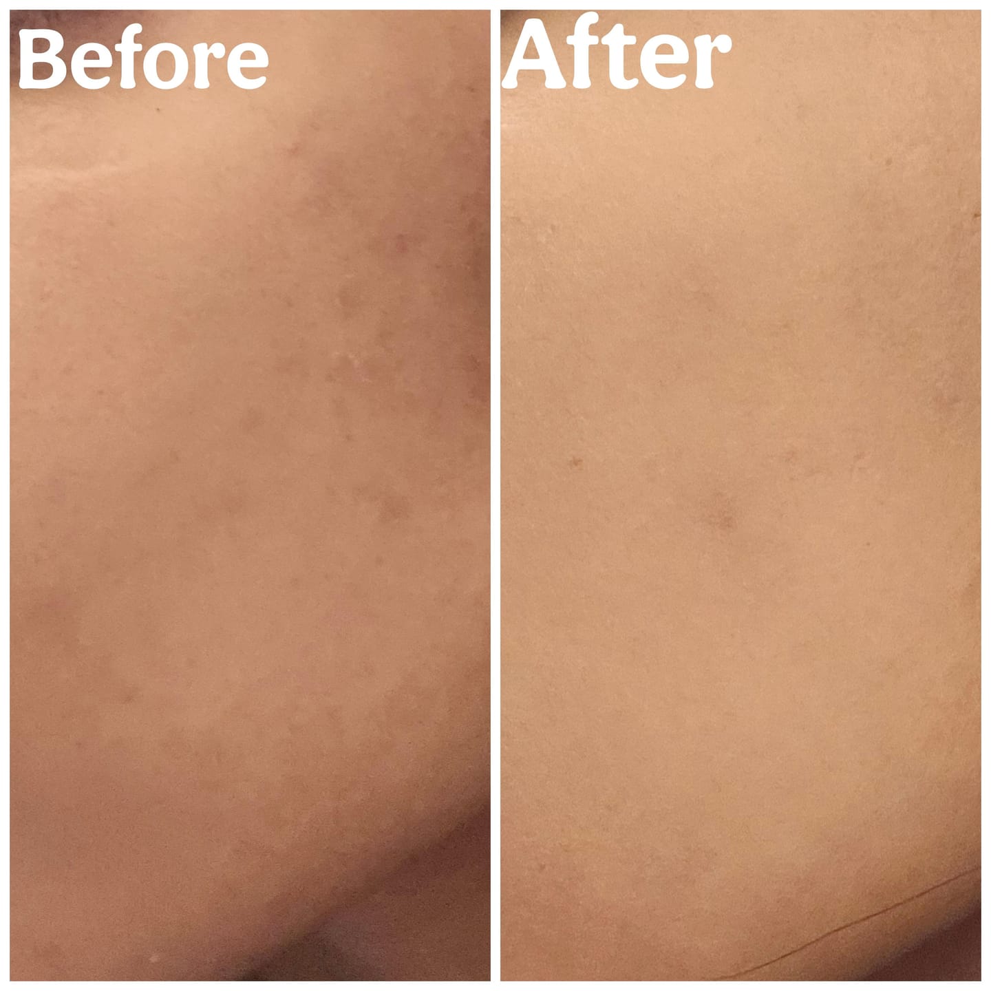 Customer photo review of Midnight Blue Calming Cream