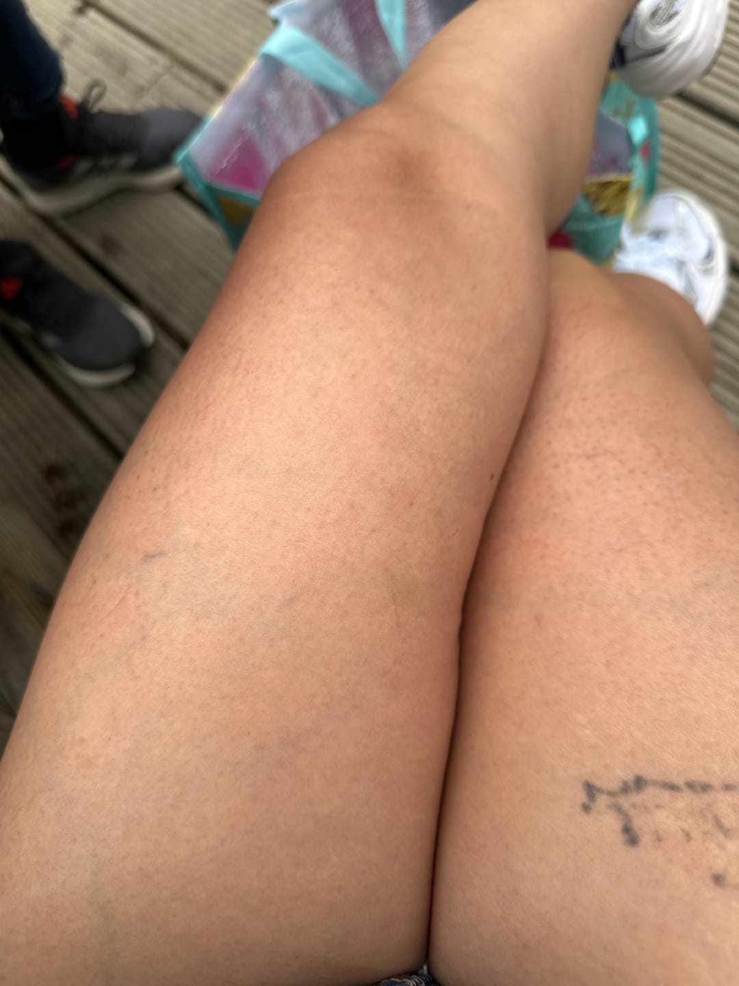 Customer photo review of Body For Us Anti-Cellulite Massage Oil