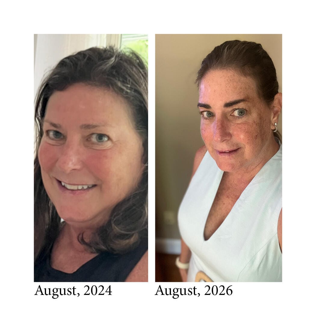 Customer photo review of OBAGi® Nu-Cil® Eyebrow Boosting Serum  0.17 oz