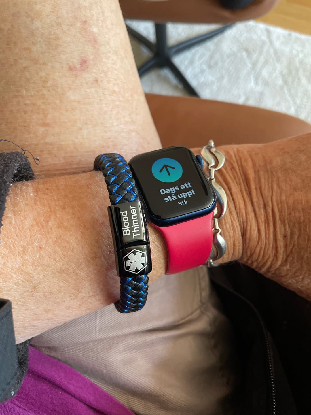 Customer photo review of Medicinskt varningsarmband