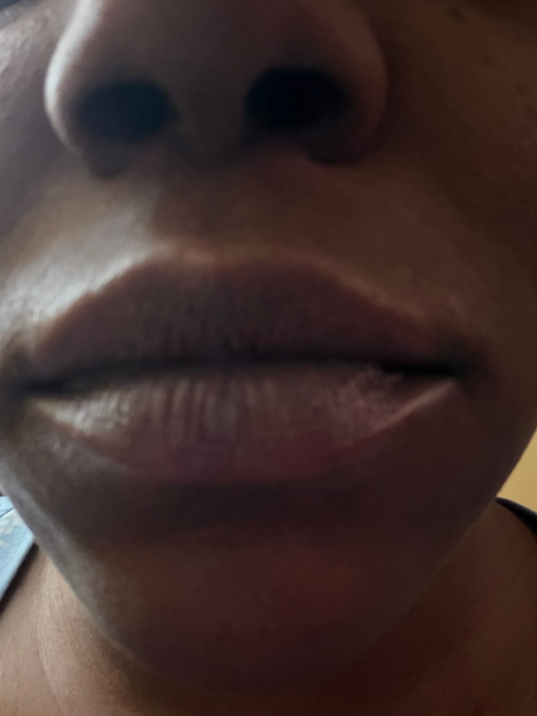 Customer photo review of Turmeric and Lemon Lip Balm (for Dark Lips)