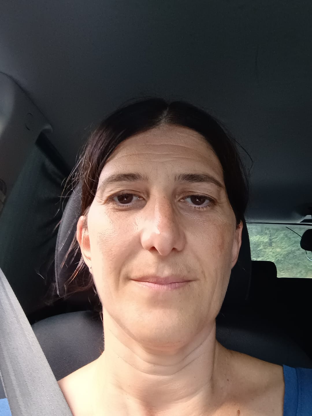 Customer photo review of BioChroma – Siero Coreano Effetto Lifting dalla Prima Applicazione
