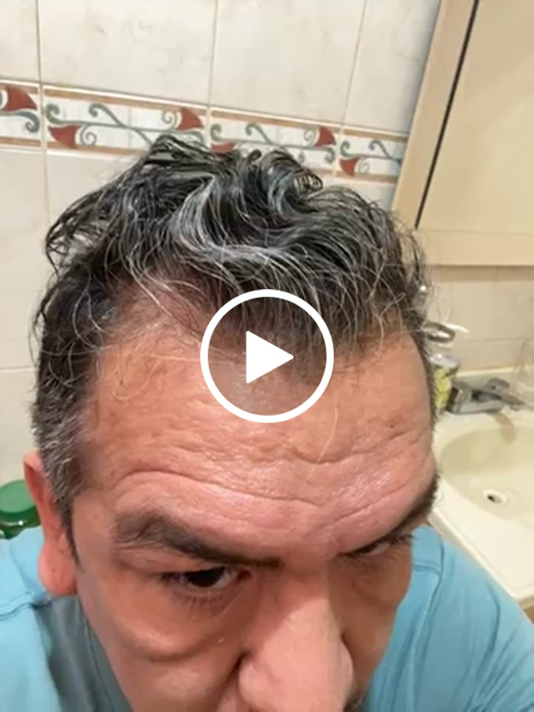 Customer video review of Minoxidil 5 mg con 90 tabletas para 3 meses de tratamiento