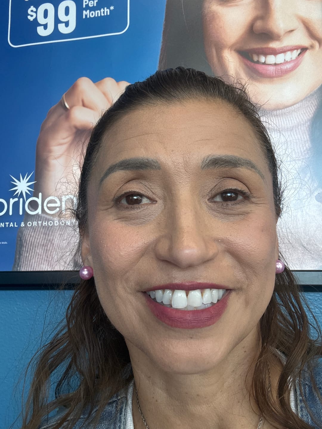 Customer photo review of EvenSkyn® Venus: Advanced Eyelid Anti-Aging Device