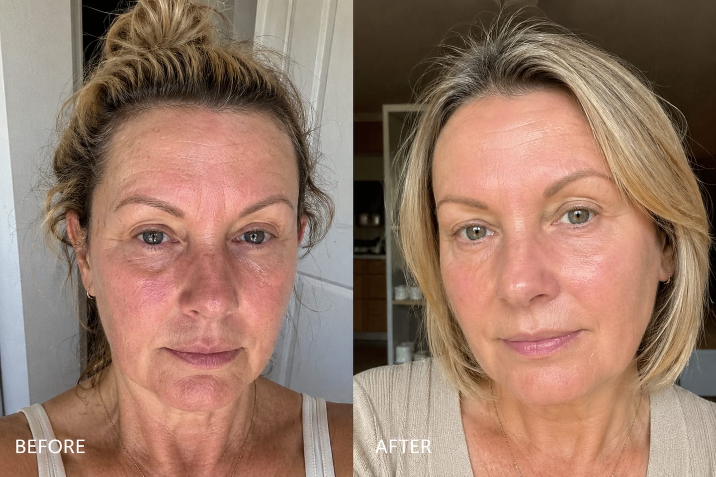 Customer photo review of LED Face Mask