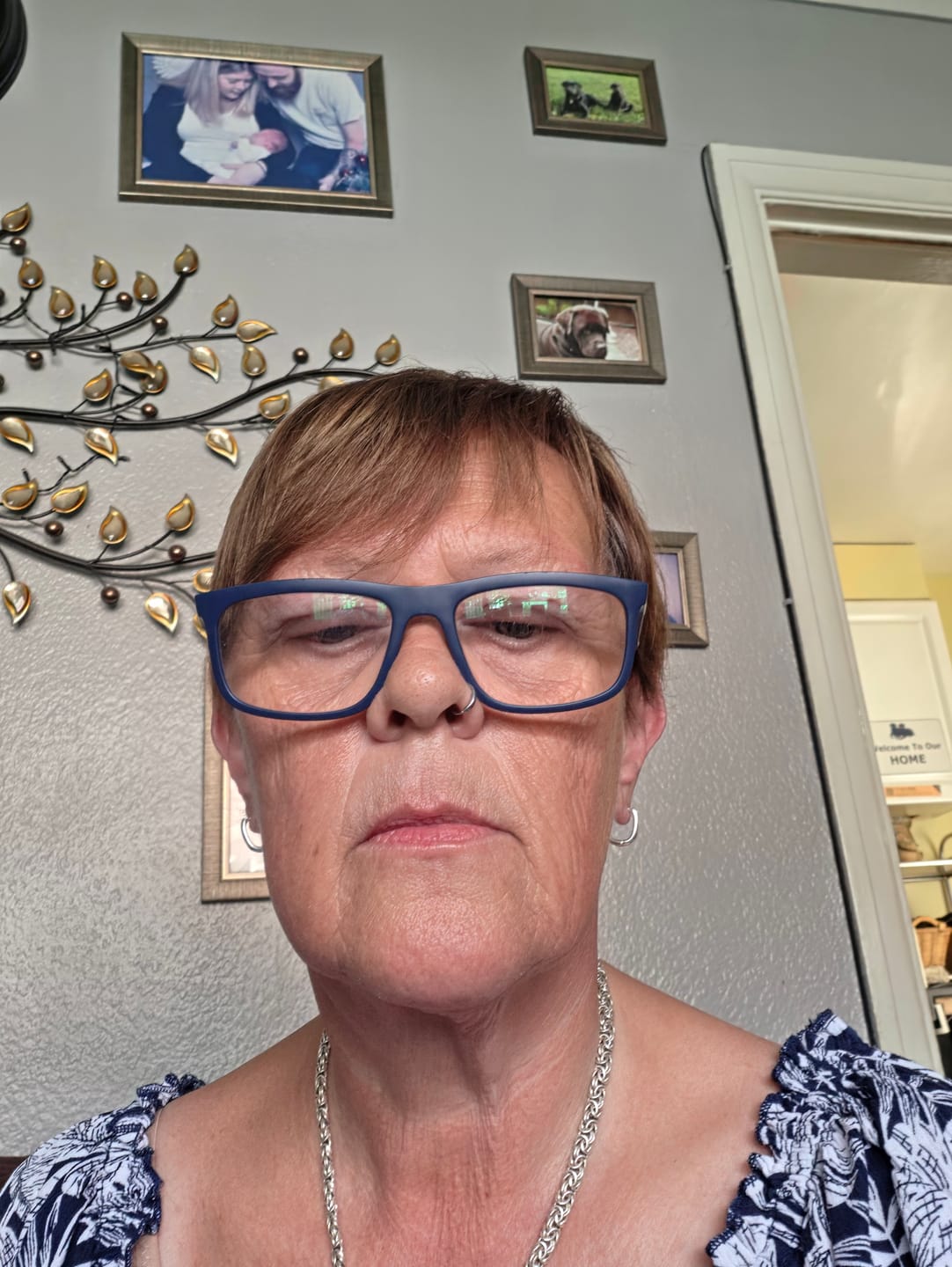 Customer photo review of Pro-Ageing Duo + FREE Cleanser, Toner, Spatula & Delivery (Worth £40)