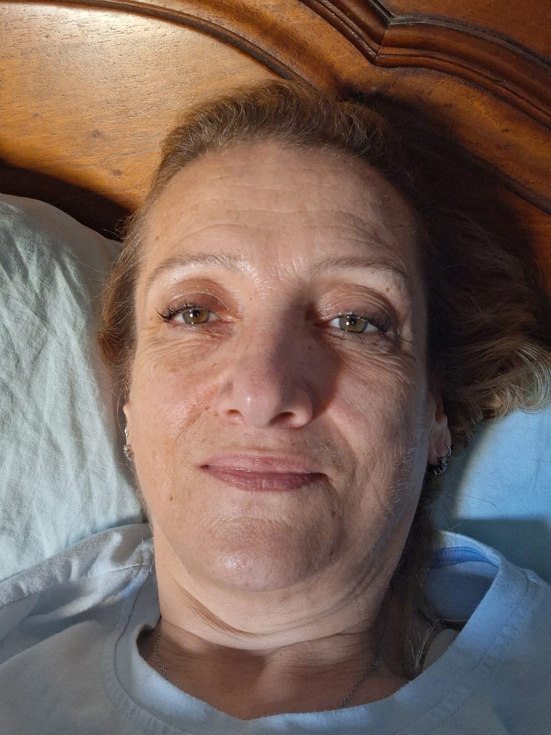 Customer photo review of BioChroma – Siero Coreano Effetto Lifting dalla Prima Applicazione