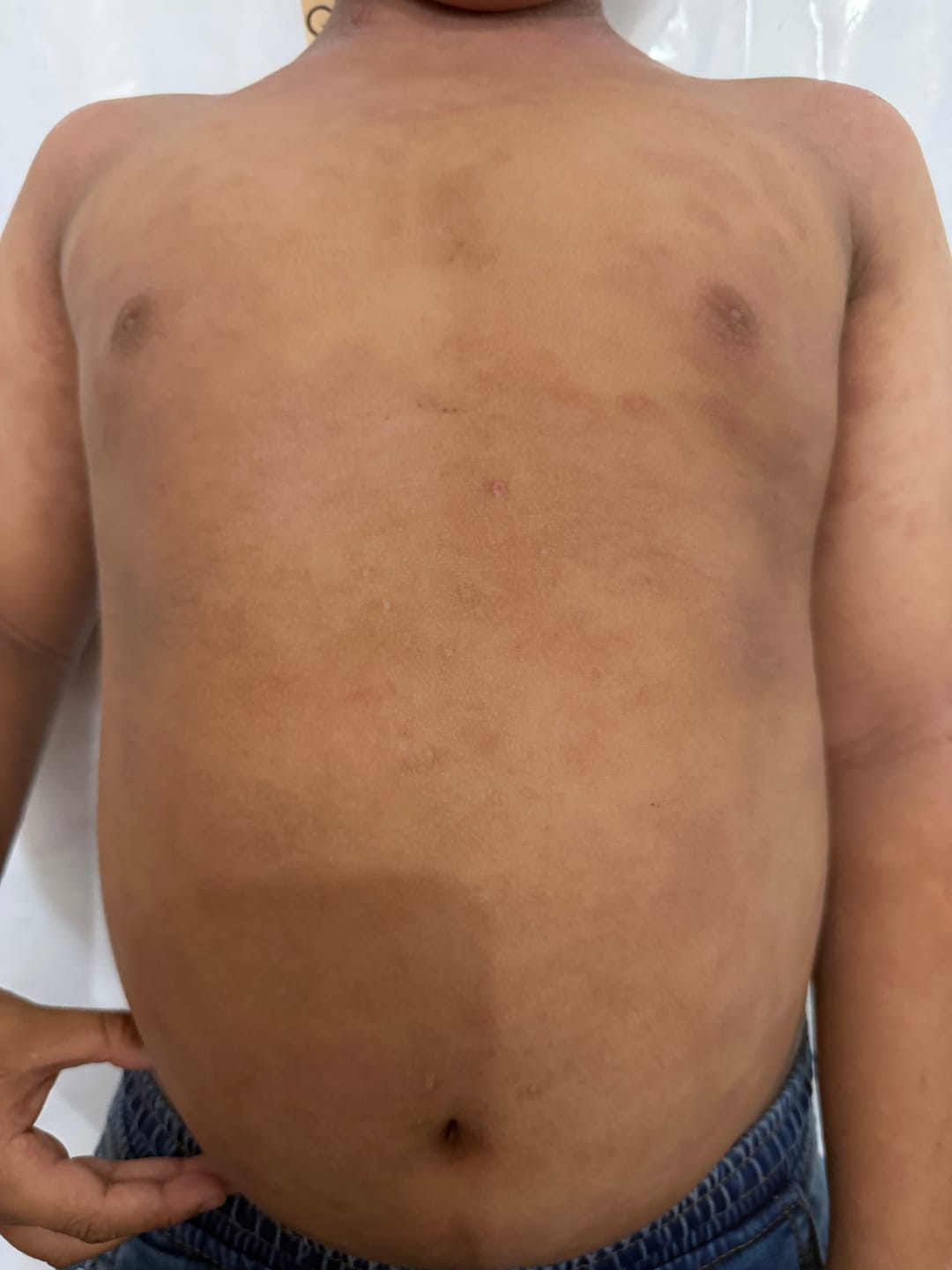 Customer photo review of Bioskin Junior Duo Pack