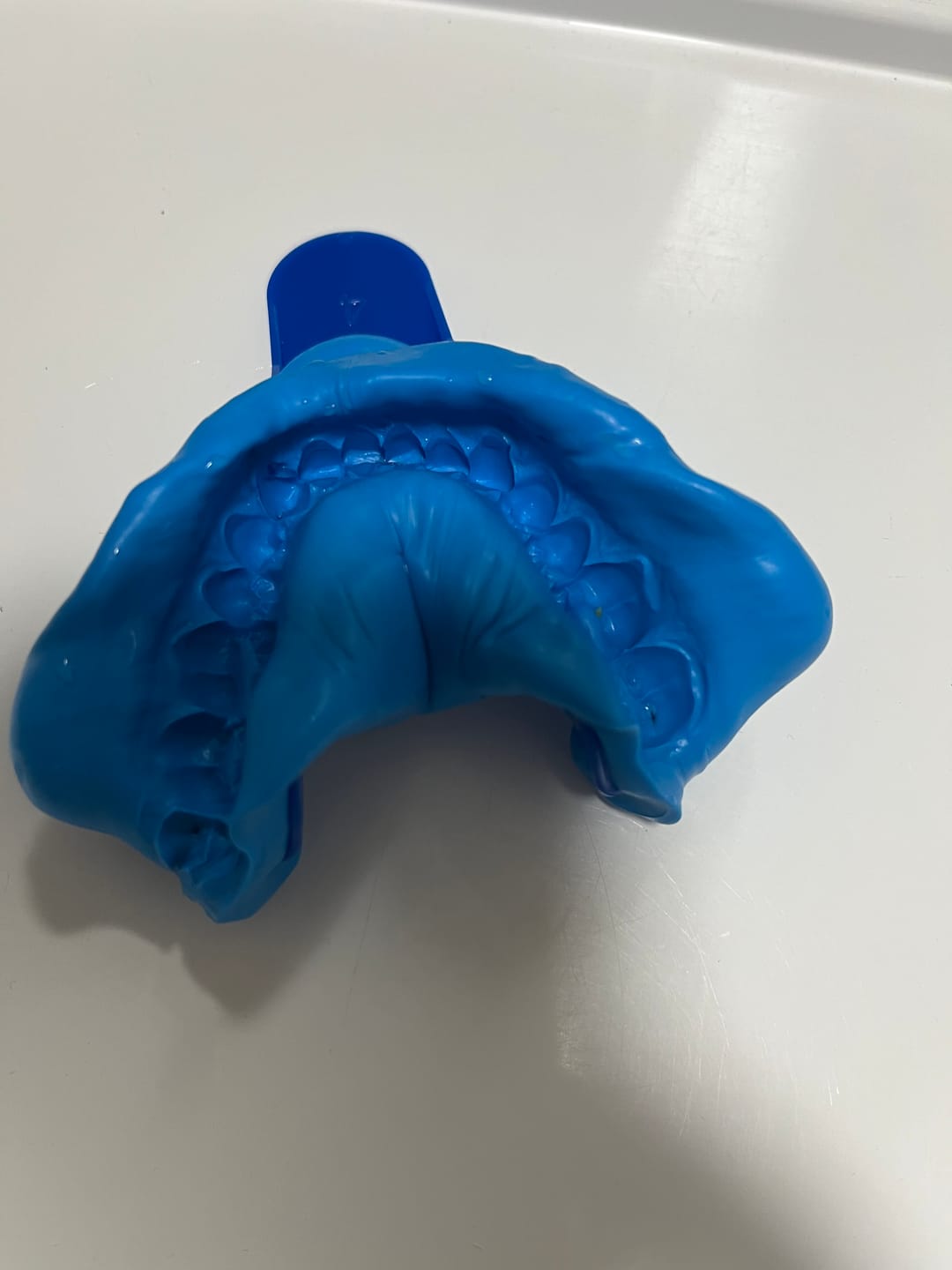Customer photo review of Essix Retainers