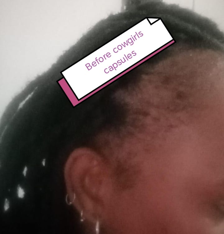 Customer photo review of Hair & Nail Capsules