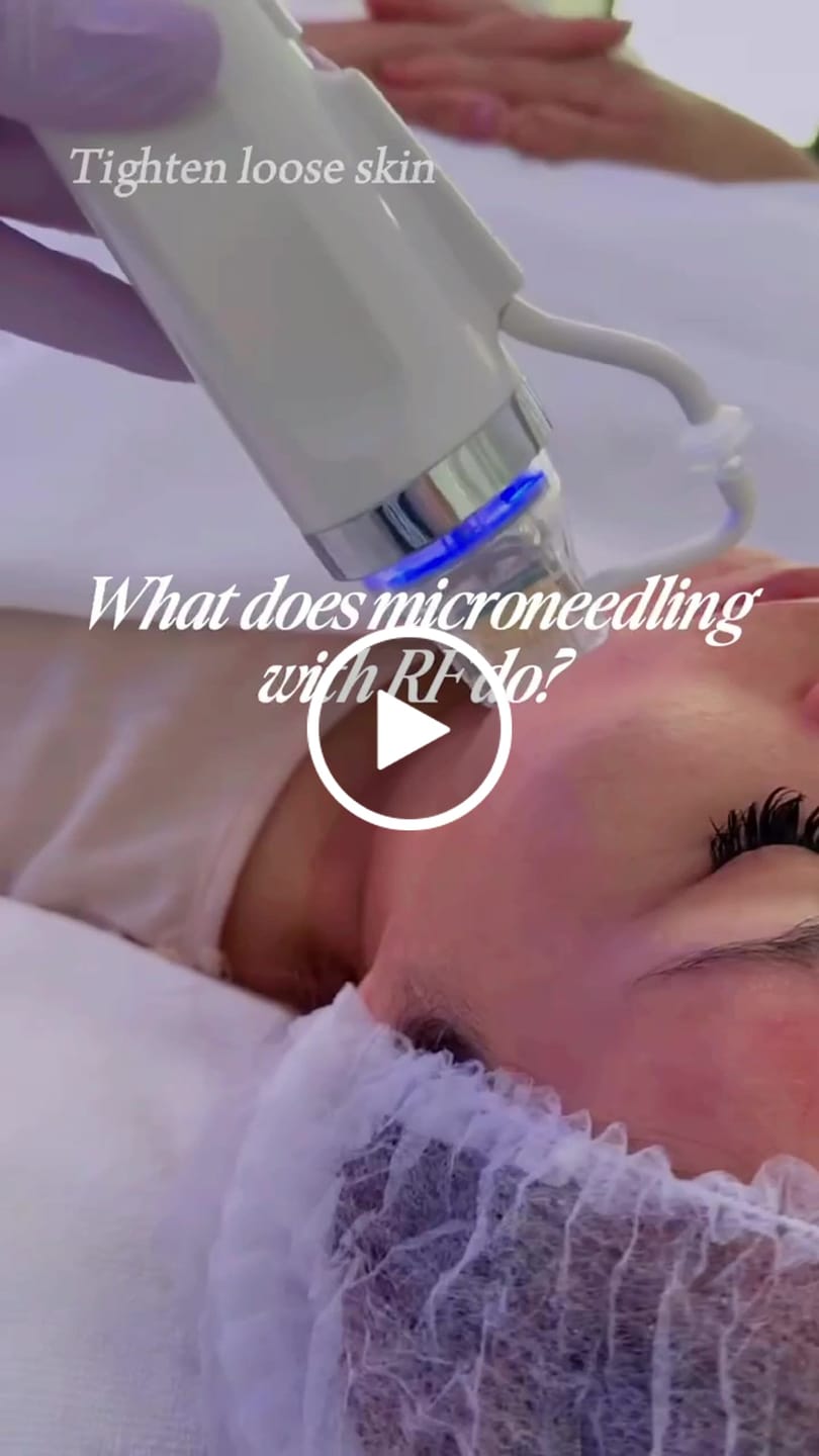 Customer video review of Replacement Cartridges for Gold RF Microneedling Machine