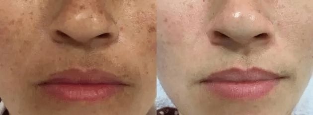 Customer photo review of SkinUp Pro