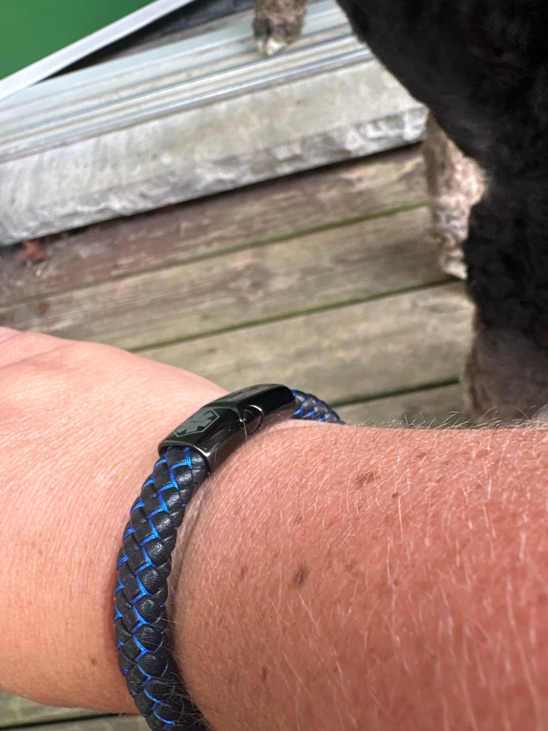 Customer photo review of Medical Alert Bracelet