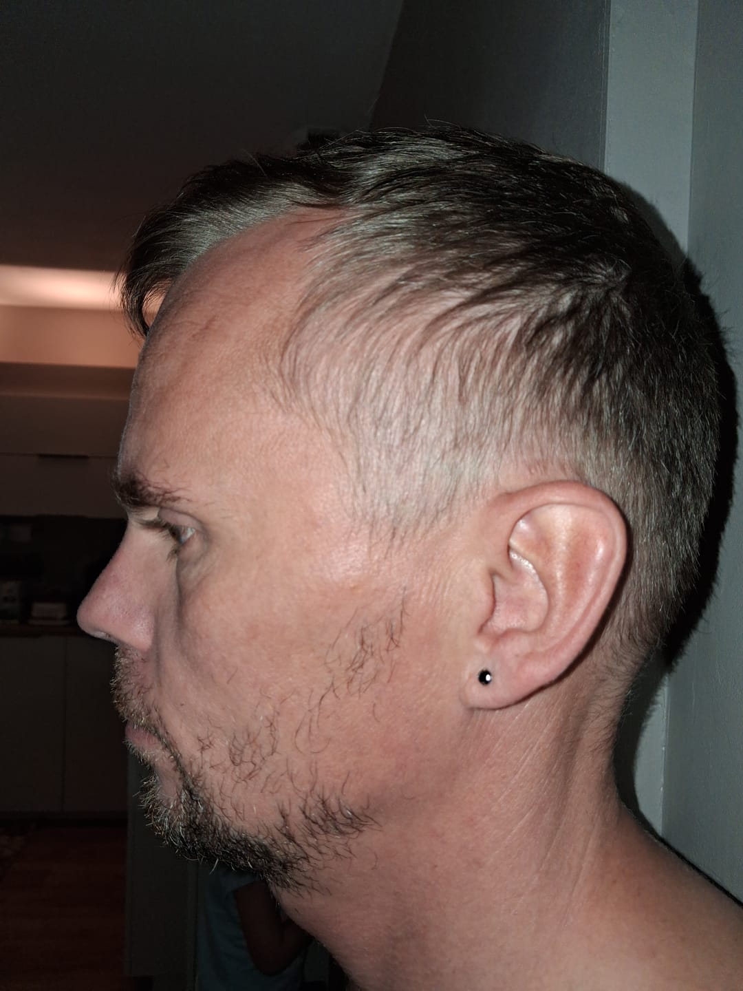 Customer photo review of Sérum Thorin | Huile de croissance de Barbe