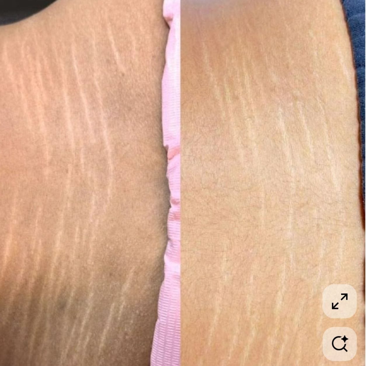 Customer photo review of Glowing Skin Routine: Glow Essentials