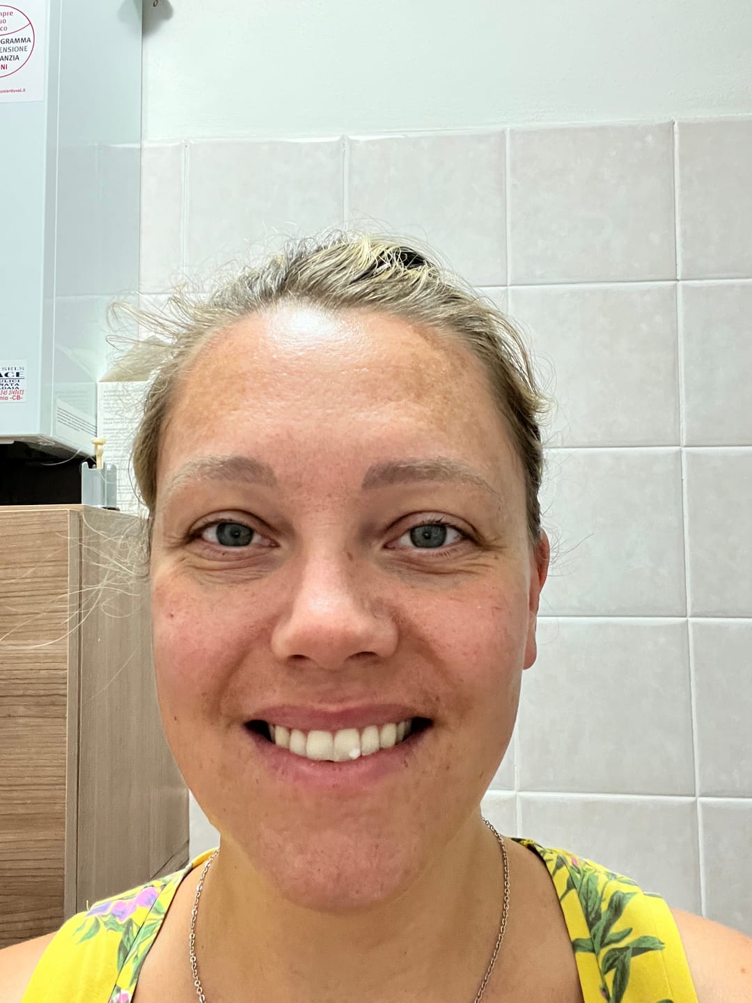 Customer photo review of Siero Luminosità Immediata PDRN - Skin Care Coreana Biochroma