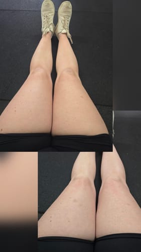Customer photo review of Self Tanning | 150 Capsules for Sunless Skin Glow
