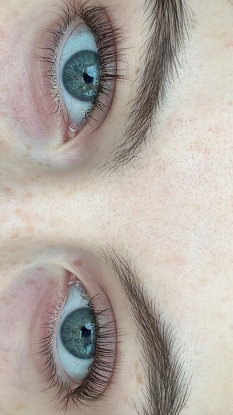 Customer photo review of Eyelash Growth Serum