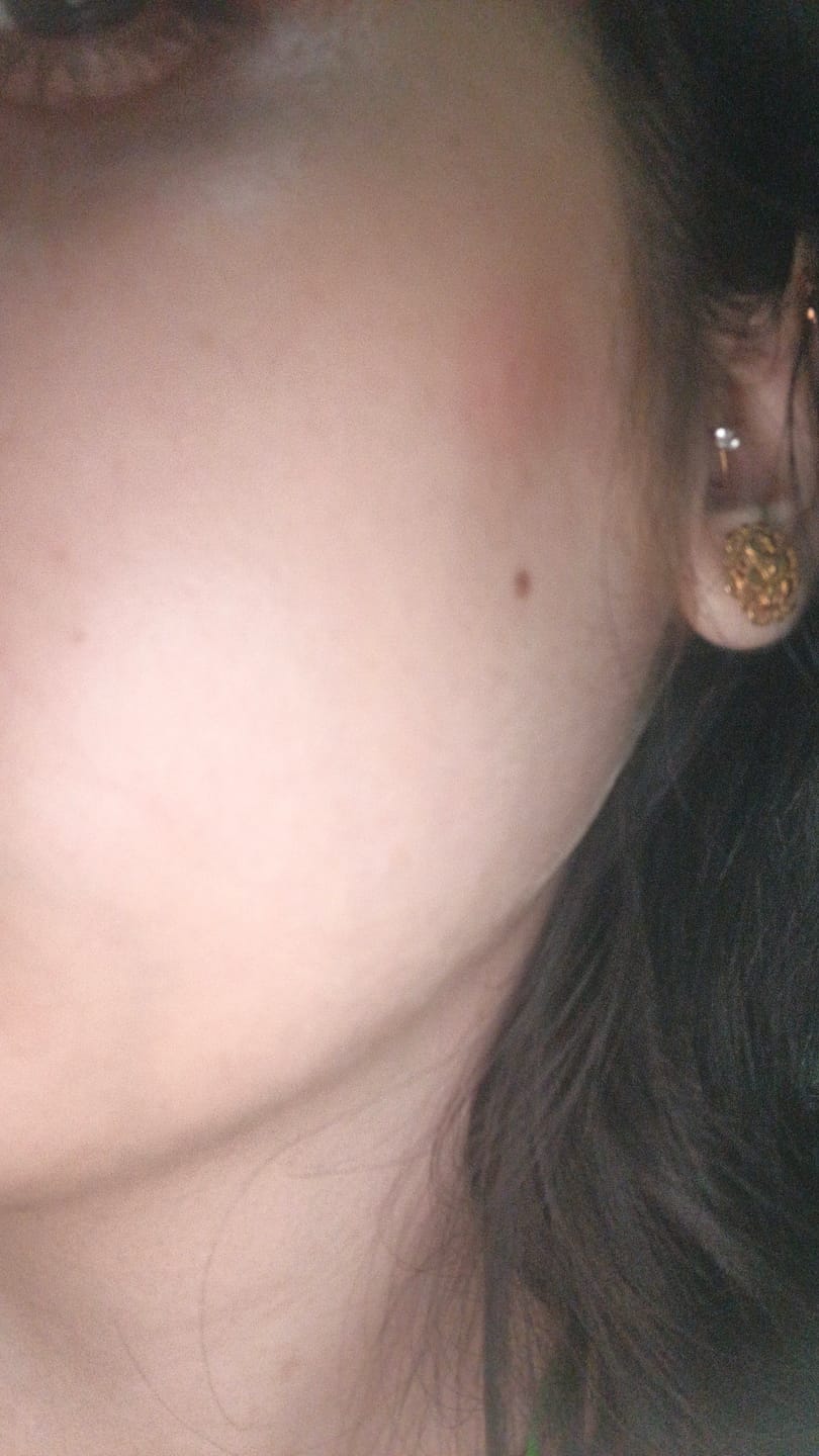 Customer photo review of Maxdif Brightening Serum